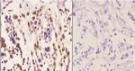 beta Arrestin 1 Antibody in Immunohistochemistry (Paraffin) (IHC (P))