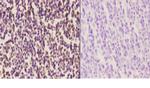 beta Arrestin 1 Antibody in Immunohistochemistry (Paraffin) (IHC (P))