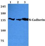 N-cadherin Antibody in Western Blot (WB)