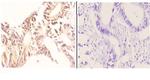 NBS1 Antibody in Immunohistochemistry (Paraffin) (IHC (P))