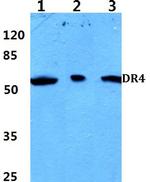 DR4 Antibody in Western Blot (WB)