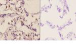 MAP2K4 Antibody in Immunohistochemistry (Paraffin) (IHC (P))