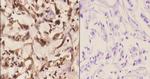 PFKP Antibody in Immunohistochemistry (Paraffin) (IHC (P))