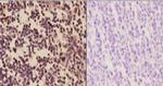 PFKP Antibody in Immunohistochemistry (Paraffin) (IHC (P))