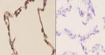 PFKP Antibody in Immunohistochemistry (Paraffin) (IHC (P))