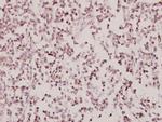 beta-2 Adrenergic Receptor Antibody in Immunohistochemistry (Paraffin) (IHC (P))