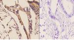 CDH17 Antibody in Immunohistochemistry (Paraffin) (IHC (P))