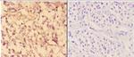 c-Abl Antibody in Immunohistochemistry (Paraffin) (IHC (P))