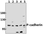 P-cadherin Antibody in Western Blot (WB)