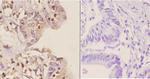 GCN5 Antibody in Immunohistochemistry (Paraffin) (IHC (P))