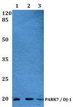 DJ-1 Antibody in Western Blot (WB)