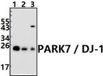 DJ-1 Antibody in Western Blot (WB)