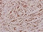 Caspase 2 Antibody in Immunohistochemistry (Paraffin) (IHC (P))