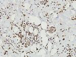 CD9 Antibody in Immunohistochemistry (Paraffin) (IHC (P))