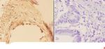 AKR1B1 Antibody in Immunohistochemistry (Paraffin) (IHC (P))