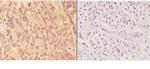 AKR1B1 Antibody in Immunohistochemistry (Paraffin) (IHC (P))