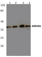 AKR1B1 Antibody in Western Blot (WB)