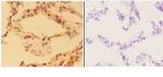 Aldolase B Antibody in Immunohistochemistry (Paraffin) (IHC (P))