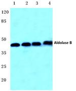 Aldolase B Antibody in Western Blot (WB)