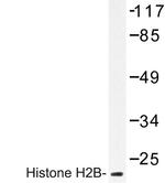 Histone H2B Antibody in Western Blot (WB)