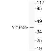 Vimentin Antibody in Western Blot (WB)