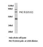 PKC theta Antibody in Western Blot (WB)