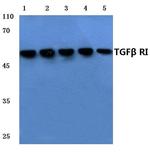 TGFBR1 Antibody in Western Blot (WB)