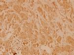 eIF4E Antibody in Immunohistochemistry (Paraffin) (IHC (P))