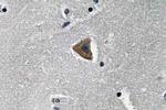 ROCK1 Antibody in Immunohistochemistry (Paraffin) (IHC (P))