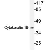 Cytokeratin 19 Antibody in Western Blot (WB)