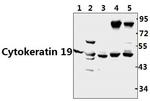 Cytokeratin 19 Antibody in Western Blot (WB)