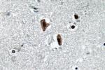 Lamin B1 Antibody in Immunohistochemistry (Paraffin) (IHC (P))