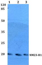 NME1 Antibody in Western Blot (WB)