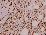 NGF Antibody in Immunohistochemistry (Paraffin) (IHC (P))