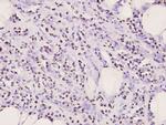 IkB alpha Antibody in Immunohistochemistry (Paraffin) (IHC (P))