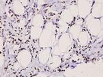 Stathmin 1 Antibody in Immunohistochemistry (Paraffin) (IHC (P))