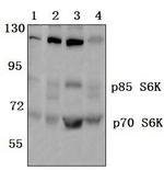 p70 S6 Kinase Antibody in Western Blot (WB)