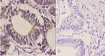 GluR2 Antibody in Immunohistochemistry (Paraffin) (IHC (P))