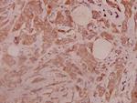 CD61 Antibody in Immunohistochemistry (Paraffin) (IHC (P))