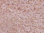 Haptoglobin Antibody in Immunohistochemistry (Paraffin) (IHC (P))