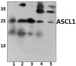 ASCL1 Antibody in Western Blot (WB)