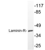 RPSA Antibody in Western Blot (WB)