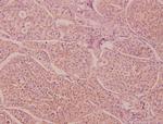 IL-16 Antibody in Immunohistochemistry (Paraffin) (IHC (P))