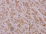 MMP12 Antibody in Immunohistochemistry (Paraffin) (IHC (P))