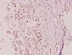 Cyclin E2 Antibody in Immunohistochemistry (Paraffin) (IHC (P))