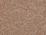 TAK1 Antibody in Immunohistochemistry (Paraffin) (IHC (P))