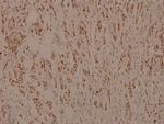 Myb Antibody in Immunohistochemistry (Paraffin) (IHC (P))