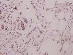 RAD51 Antibody in Immunohistochemistry (Paraffin) (IHC (P))