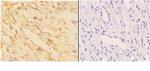 ACAT1 Antibody in Immunohistochemistry (Paraffin) (IHC (P))