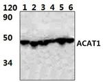 ACAT1 Antibody in Western Blot (WB)